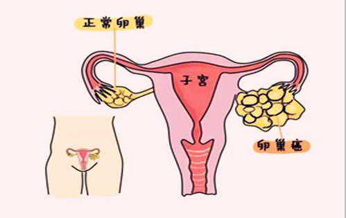 香港验血有y却生出女孩,不知不觉就怀不上了？附最全男女不孕不育排查方法