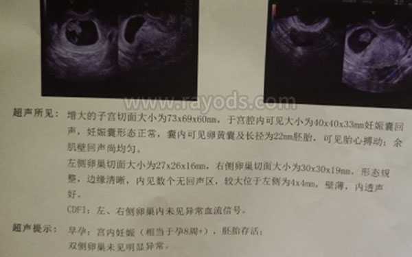 邮寄香港验血准吗,子宫肌瘤能做试管婴儿吗