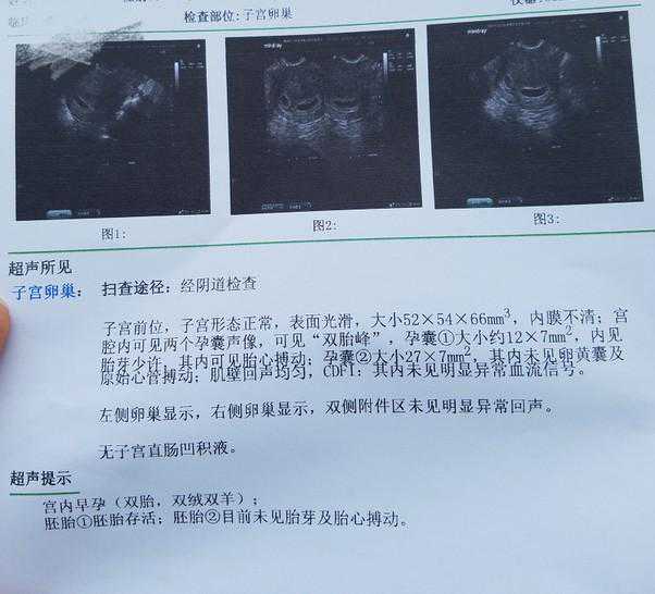 香港验血 周末可以吗,做试管移植14天血值318怕生化，一超意外双胎，脾气都磨