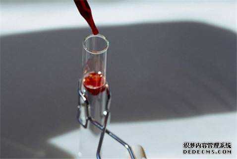 香港验血邮寄设备_香港验血查性别出错的吗_抽血鉴定性别要多少费用!